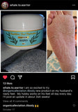 “Organic Alleviation” Healthier Foot Hydration - Massage Lotion